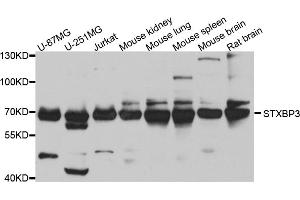 Western blot analysis of extracts of various cell lines, using STXBP3 antibody (ABIN5974503) at 1/1000 dilution. (STXBP3 anticorps)