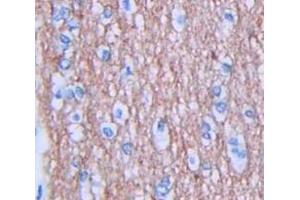 IHC-P analysis of Human Tissue, with DAB staining. (JAG1 anticorps  (AA 470-834))