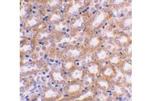 Immunohistochemical staining of mouse kidney using AP30447PU-N IRF3 antibody at 2 μg/ml.