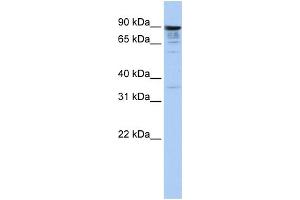 WB Suggested Anti-MCTP1 Antibody Titration:  1 ug/ml  Positive Control:  Hela cell lysate (MCTP1 anticorps  (Middle Region))