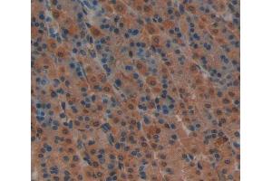 Used in DAB staining on fromalin fixed paraffin- embedded stomach tissue
