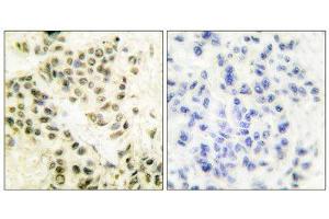 Immunohistochemistry (IHC) image for anti-Protein Kinase, DNA-Activated, Catalytic Polypeptide (PRKDC) (C-Term) antibody (ABIN1848510) (PRKDC anticorps  (C-Term))