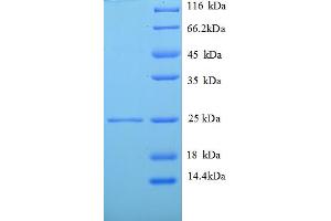 SDS-PAGE (SDS) image for Vesicle-Associated Membrane Protein 7 (VAMP7) (AA 2-186), (Cytoplasmic Domain), (Cytosolic) protein (His tag) (ABIN5710606)
