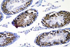 IHC analysis of DDX4 using anti-DDX4 antibody (ABIN7601203). (DDX4 anticorps  (AA 3-666))