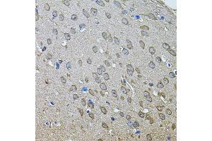 Immunohistochemistry of paraffin-embedded mouse brain using ANXA8L2 antibody (ABIN5975720) at dilution of 1/100 (40x lens). (ANXA8L2 anticorps)