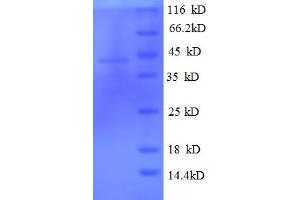 SDS-PAGE (SDS) image for Tubulin Folding Cofactor C (TBCC) (AA 2-345) protein (His tag) (ABIN5710458)