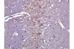 Formalin-fixed and paraffin embedded rat brain labeled with Anti-phospho-CaMK2 alpha (Tyr231) Polyclonal Antibody, Unconjugated (ABIN683848) at 1:200 followed by conjugation to the secondary antibody and DAB staining