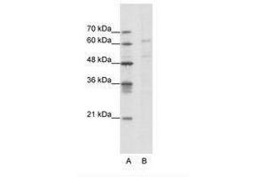 Image no. 1 for anti-Calcium Channel, Voltage-Dependent, beta 3 Subunit (CACNB3) (AA 391-440) antibody (ABIN202640) (CACNB3 anticorps  (AA 391-440))
