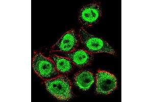 Immunofluorescence (IF) image for anti-Thymidylate Synthetase (TYMS) antibody (ABIN3002747)
