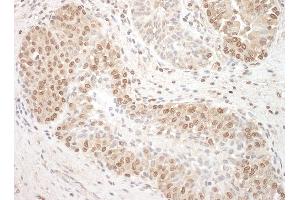 anti-Tuftelin Interacting Protein 11 (TFIP11) (AA 1-50) antibody