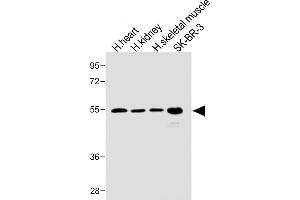All lanes : Anti-SPNS2 Antibody (N-term) at 1:1000 dilution Lane 1: Human heart lysate Lane 2: Human kidney lysate Lane 3: Human skeletal muscle lysate Lane 4: SK-BR-3 whole cell lysate Lysates/proteins at 20 μg per lane.
