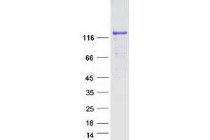 Validation with Western Blot
