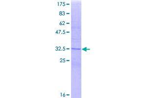 Image no. 1 for CD81 (CD81) (AA 25-127) protein (GST tag) (ABIN1348710)