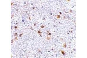Immunohistochemistry (IHC) image for anti-Programmed Cell Death 1 Ligand 2 (PDCD1LG2) (Middle Region) antibody (ABIN1031035)