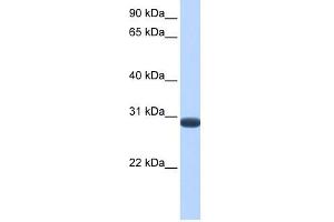 DUSP19 antibody used at 1 ug/ml to detect target protein.