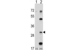 Western Blotting (WB) image for anti-Proteasome (Prosome, Macropain) Subunit, beta Type, 5 (PSMB5) antibody (ABIN2998050) (PSMB5 anticorps)