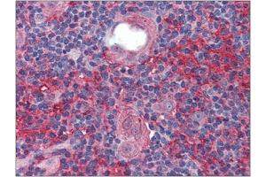 Immunohistochemistry: Human Thymus: Formalin-Fixed, Paraffin-Embedded (FFPE). (Cell Adhesion Molecule 4 anticorps  (Internal Region))