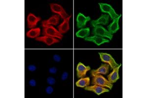 ABIN7094479 and ABIN7098528 staining Hela cells by IF/ICC.
