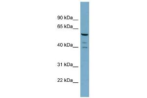 WB Suggested Anti-RABGEF1 Antibody Titration: 0. (RABGEF1 anticorps  (N-Term))