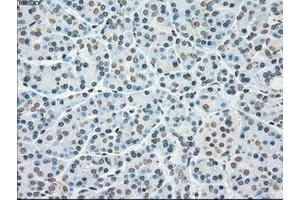 Image no. 5 for anti-Polo-Like Kinase 1 (PLK1) antibody (ABIN1500283)