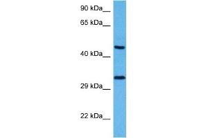 Host:  Mouse  Target Name:  SOX1  Sample Tissue:  Mouse Pancreas  Antibody Dilution:  1ug/ml