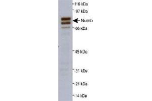 Western blot analysis of Numb isoforms 1 and 2 in A-431 whole cell lysate (20 ug) with Numb polyclonal antibody at 0. (NUMB anticorps  (AA 600-653))