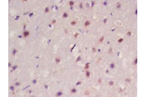 Formalin-fixed and paraffin embedded rat brain labeled with Rabbit Anti-Frizzled 10/CD350 Polyclonal Antibody, Unconjugated  at 1:200 followed by conjugation to the secondary antibody and DAB staining (FZD10 anticorps  (AA 101-200))