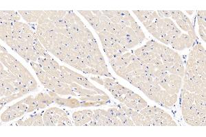 Detection of IL1b in Caprine Cardiac Muscle Tissue using Polyclonal Antibody to Interleukin 1 Beta (IL1b)