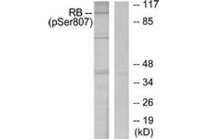 Western blot analysis of extracts from K562 cells treated with serum 10%, using Retinoblastoma (Phospho-Ser807) Antibody. (Retinoblastoma Protein (Rb) anticorps  (pSer807))