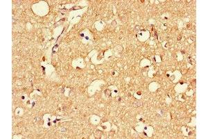 Immunohistochemistry of paraffin-embedded human brain tissue using ABIN7159344 at dilution of 1:100 (MLC1 anticorps  (AA 1-49))