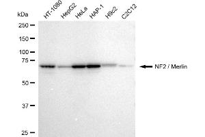 Western blotting analysis using NF2 / Merlin antibody (ABIN7799579). (Recombinant Merlin anticorps)