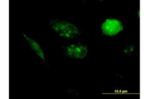 Immunofluorescence of purified MaxPab antibody to AURKAIP1 on HeLa cell. (AURKAIP1 anticorps  (AA 1-199))