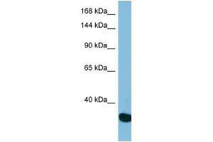 Western Blotting (WB) image for anti-Ubiquitin Specific Peptidase 36 (USP36) (N-Term) antibody (ABIN2787328) (USP36 anticorps  (N-Term))