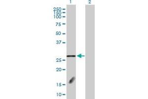 Western Blot analysis of FBXL18 expression in transfected 293T cell line by FBXL18 MaxPab polyclonal antibody. (FBXL18 anticorps  (AA 1-259))