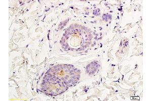 Formalin-fixed and paraffin embedded rat skin labeled with Rabbit Anti NR2A/NMDAR2A Polyclonal Antibody, Unconjugated (ABIN747353) at 1:200 followed by conjugation to the secondary antibody and DAB staining