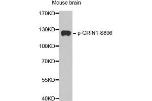 Western blot analysis of extracts from mouse Brain tissue, using phospho-GRIN1-S896 antibody (ABIN2987488). (GRIN1/NMDAR1 anticorps  (pSer896))