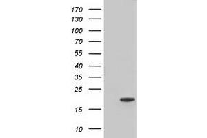 HEK293T cells were transfected with the pCMV6-ENTRY control (Left lane) or pCMV6-ENTRY TTC32 (Right lane) cDNA for 48 hrs and lysed. (TTC32 anticorps)