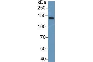 Detection of NEF3 in Mouse Spinal cord lysate using Polyclonal Antibody to Neurofilament 3 (NEF3)