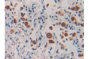 IHC-P analysis of Human Lung Tissue, with DAB staining.