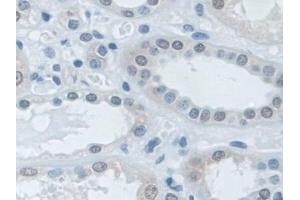 Detection of ILF3 in Human Kidney Tissue using Polyclonal Antibody to Interleukin Enhancer Binding Factor 3 (ILF3) (Interleukin enhancer-binding factor 3 (ILF3) (AA 672-891) anticorps)