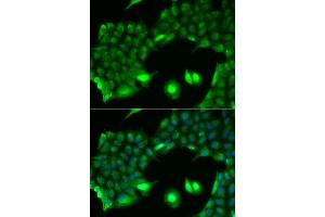 Immunofluorescence analysis of HeLa cell using SSX2 antibody. (SSX2 anticorps)