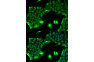 Immunofluorescence analysis of HeLa cell using SSX2 antibody. (SSX2 anticorps)