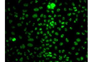 Immunofluorescence analysis of HeLa cells using MKI67 antibody (ABIN5998234). (Ki-67 anticorps)