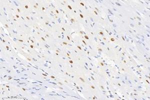 Immunohistochemistry analysis of paraffin-embedded rat heart using,SET (ABIN7075583) at dilution of 1: 10000