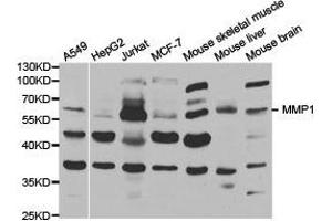 Western Blotting (WB) image for anti-Matrix Metallopeptidase 1 (Interstitial Collagenase) (MMP1) antibody (ABIN1873712) (MMP1 anticorps)