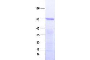 Validation with Western Blot