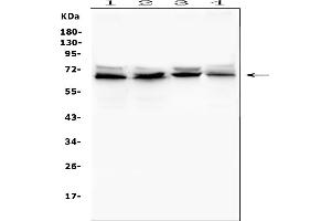 Western blot analysis of IFNAR2 using anti-IFNAR2 antibody (ABIN7601353). (IFNAR2 anticorps  (AA 33-466))