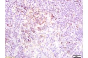 Formalin-fixed and paraffin embedded mouse spleen labeled with Rabbit Anti-TSHR Polyclonal Antibody (ABIN668901) at 1:200 followed by conjugation to the secondary antibody and DAB staining (TSH receptor anticorps  (AA 501-600))