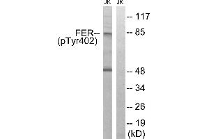 Immunohistochemistry analysis of paraffin-embedded human brain tissue using FER (Phospho-Tyr402) antibody. (FER anticorps  (pTyr402))