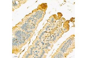 Immunohistochemistry of paraffin embedded mouse duodenum using SLC6A19 (ABIN7075682) at dilution of 1:900 (400x lens)